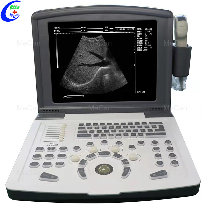 High Quality Full Digital Portable B/W Ultrasound Machine 7