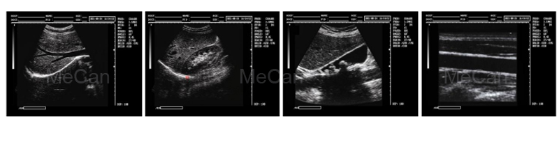 High Quality Full Digital Portable B/W Ultrasound Machine 8