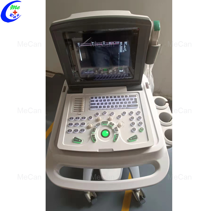 High Quality Full Digital Portable B/W Ultrasound Machine 9