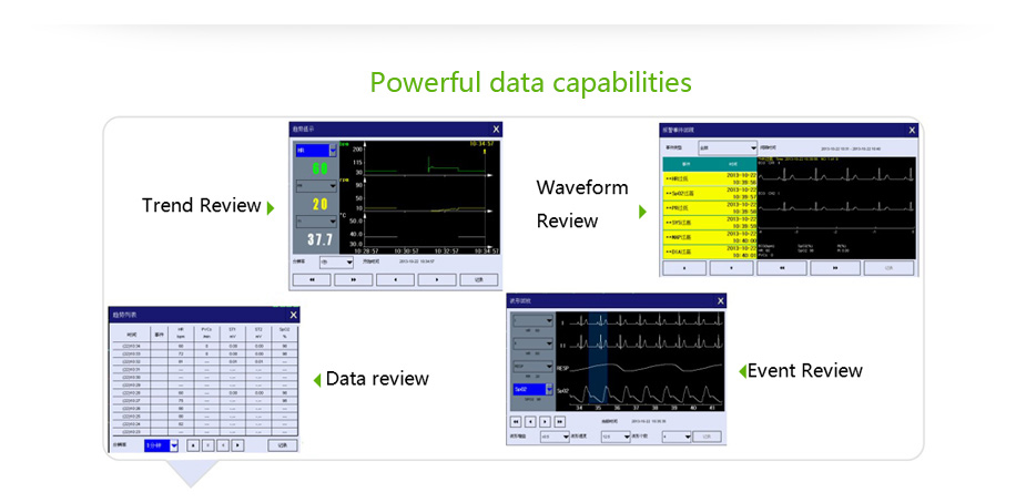 Multi Parameter ICU Patient Monitor System 7