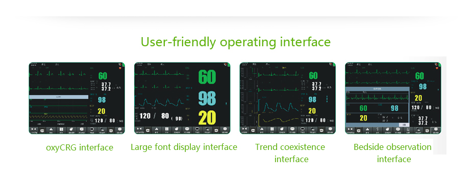 Multi Parameter ICU Patient Monitor System 11