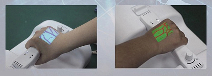 vein finder vein finder