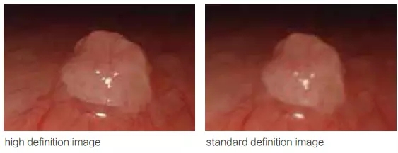 Video Endoscopy Gastroscope And Colonoscope System Video Endoscopy Gastroscope And Colonoscope System