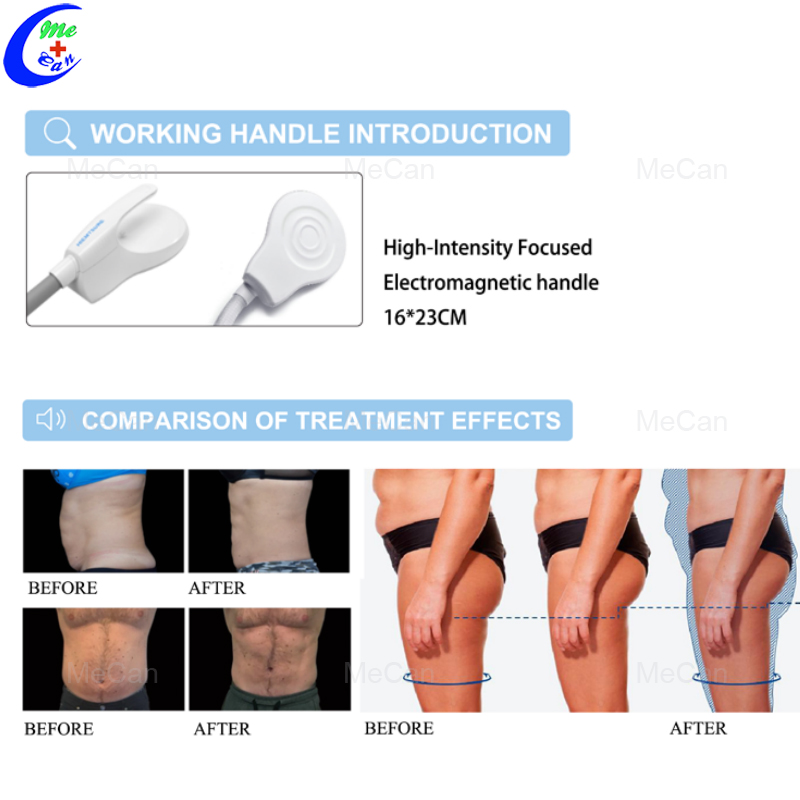 High Frequency Body Muscle Stimulation Electromagnetic Vibration Body Sculpting Machine 10