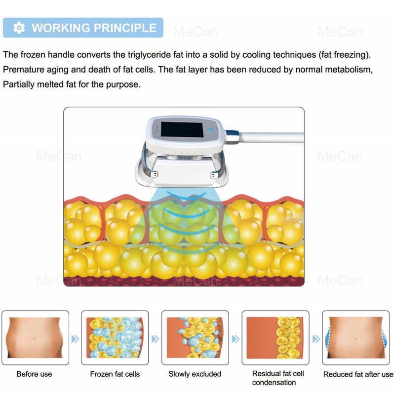Factory Price Non-surgical Vertical 360° Criolipolisis Weightloss Machine 8