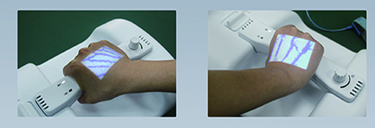 Venous Transfusion Assistant Vein Finder Venous Transfusion Assistant Vein Finder