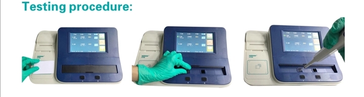 Immuno Protein Analyzer Immuno Protein Analyzer