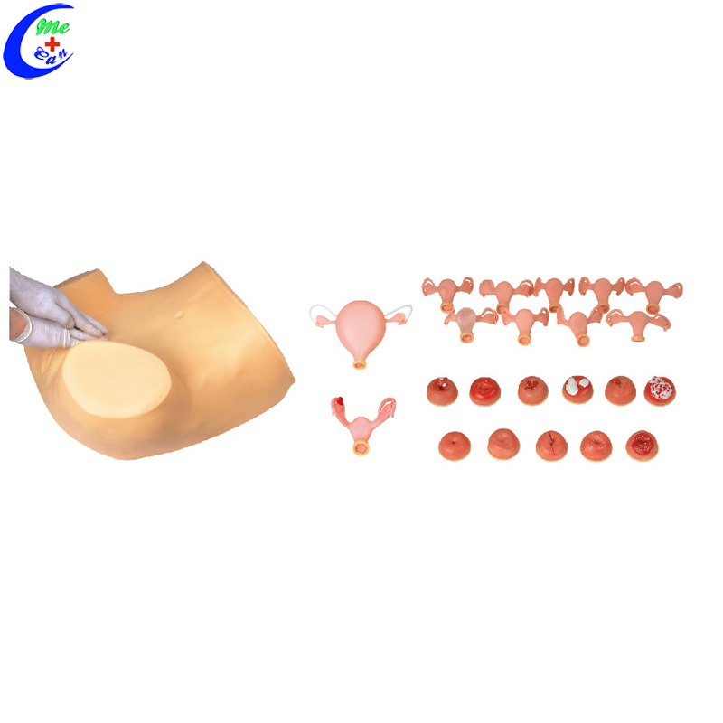 Advanced Gynecological Examination Simulator Advanced Gynecological Examination Simulator