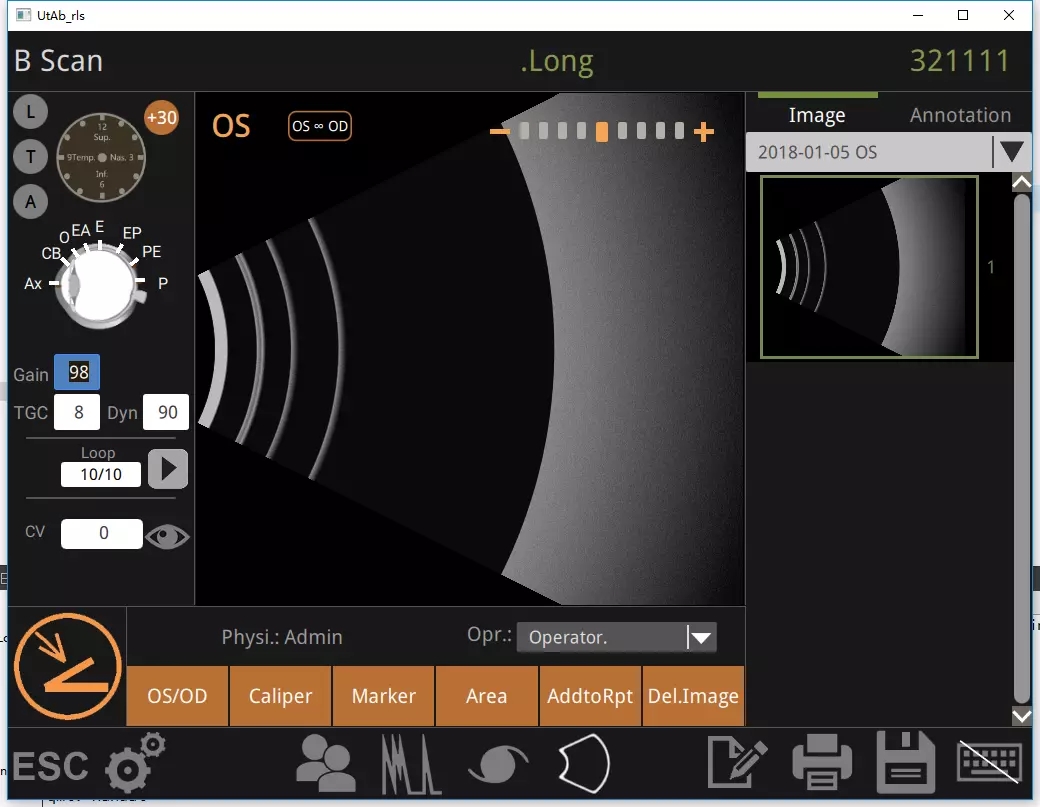 Ultrasonic A/B Scanner for Ophthalmology Ultrasonic A/B Scanner for Ophthalmology