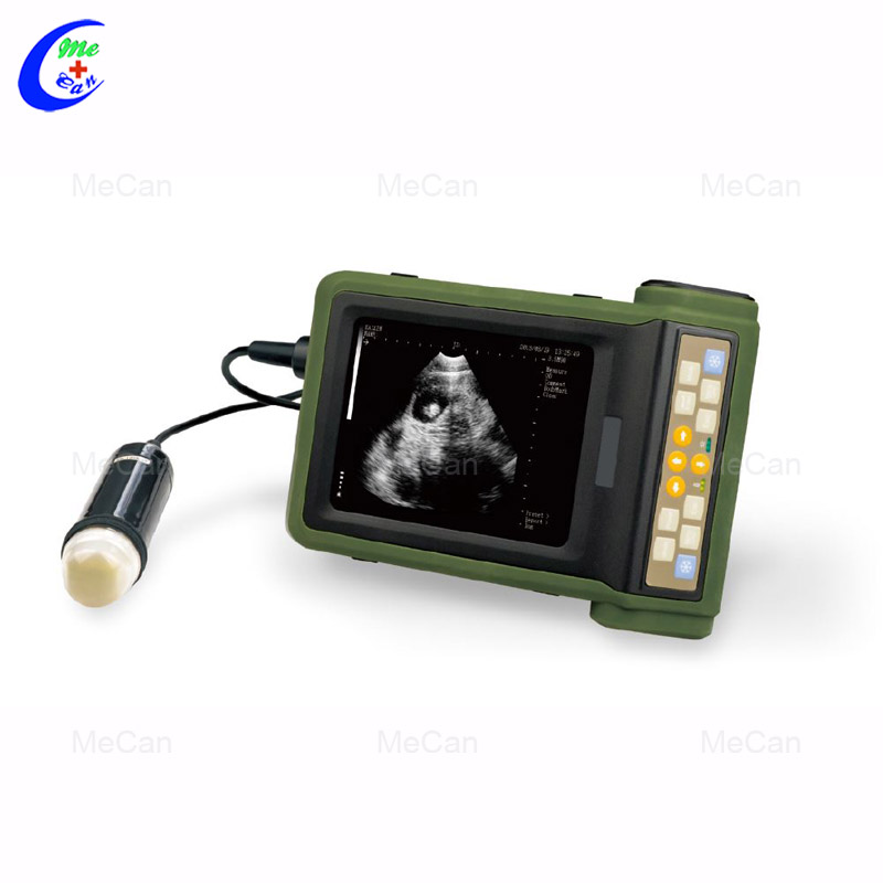 Hot Sale China Medical Doppler Ultrasound Machine 8