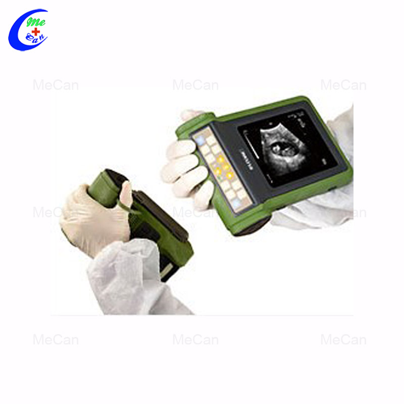 Hot Sale China Medical Doppler Ultrasound Machine 12