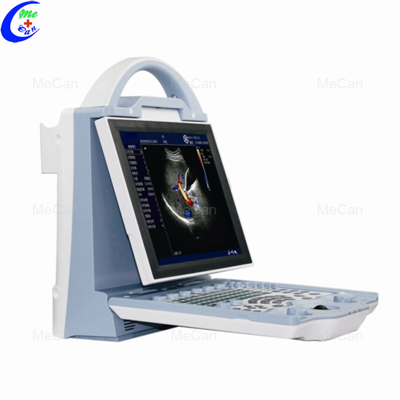 Full Digital Portable Color Doppler Ultrasound Scanner 5