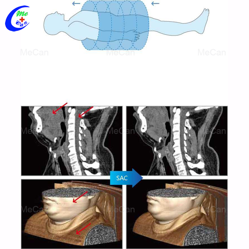High Quality Hospital 16-slice CT Scanner with Optimal Resolution 9