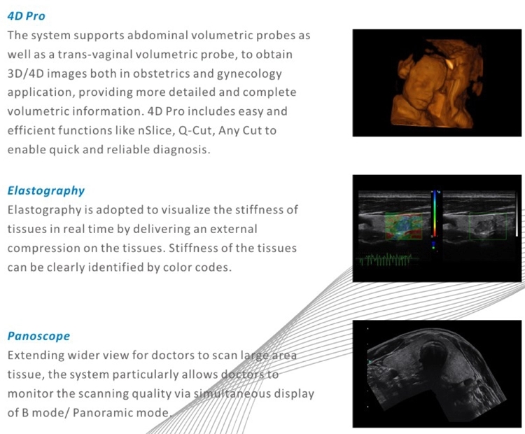 Color Doppler Pregnancy 3D Portable USG Ultrasound Scanner 5