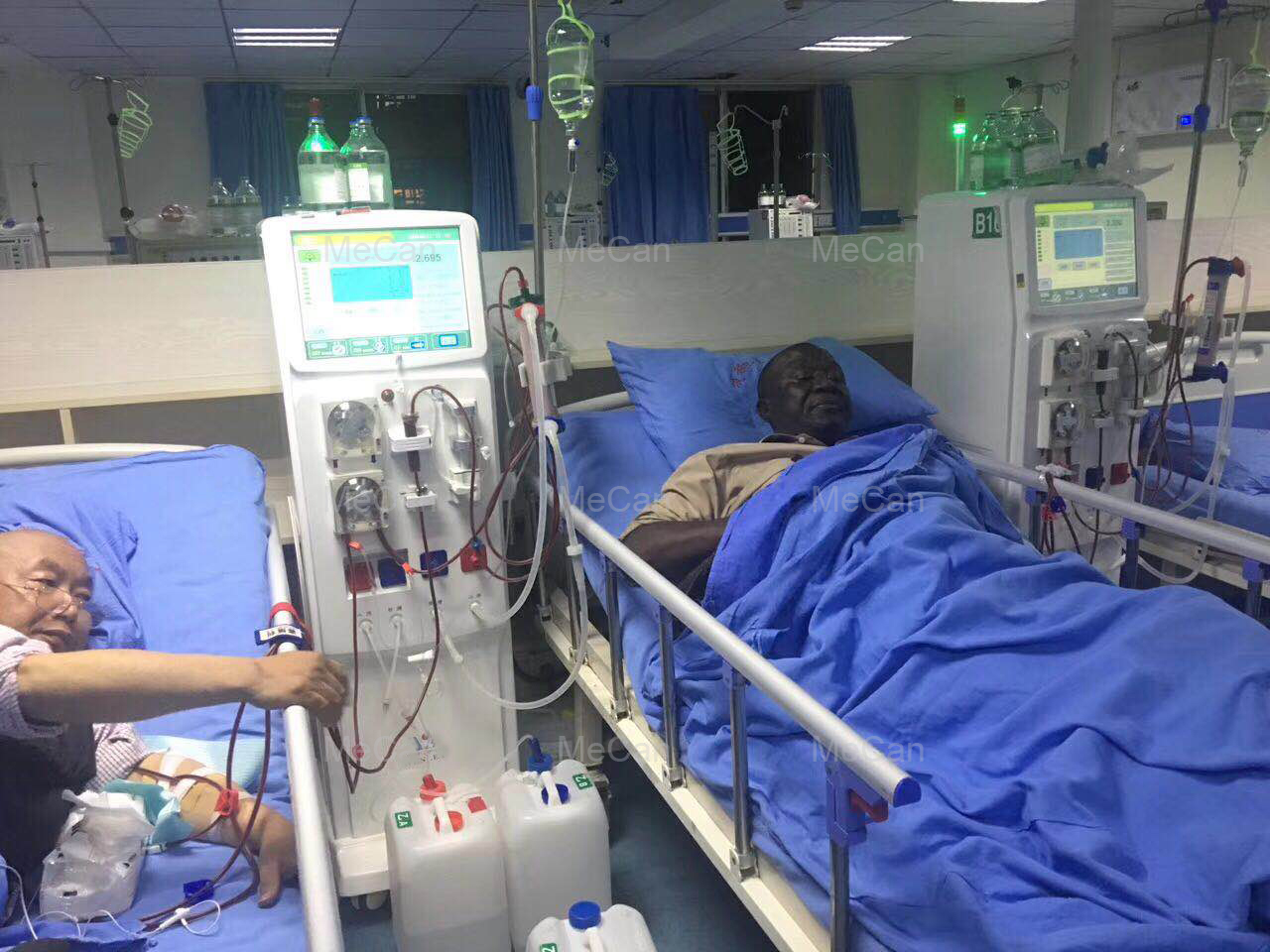Double Pump Hemodialyse Machine Hemodialysis Machine 11