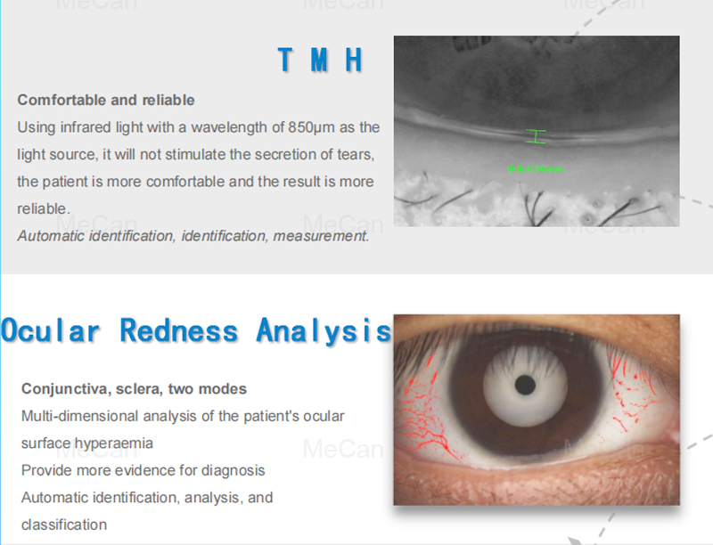 Medical Dry Eye Examination Meibography Infrared Dry Eye Ocular Surface Analyzer 8
