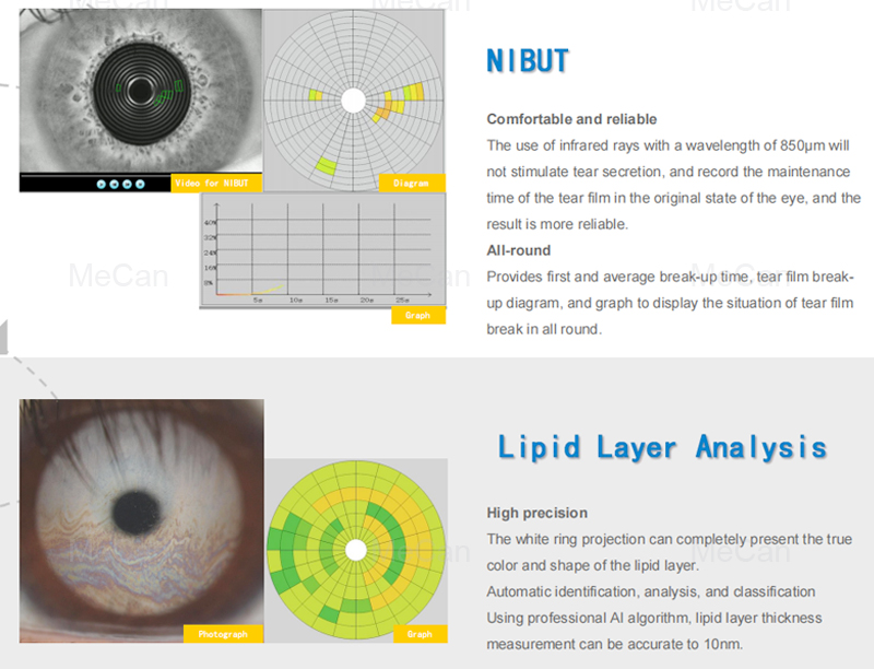 Medical Dry Eye Examination Meibography Infrared Dry Eye Ocular Surface Analyzer 10
