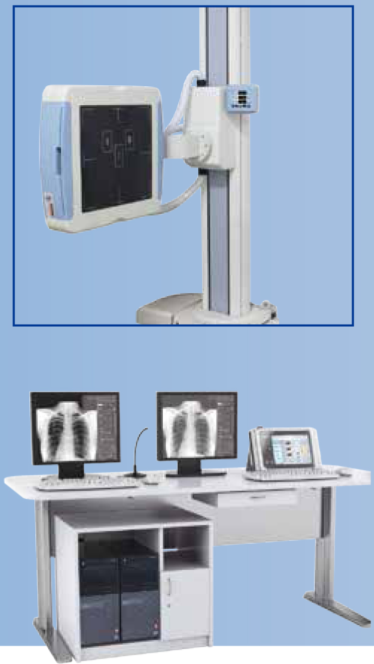 digital x-ray digital x-ray