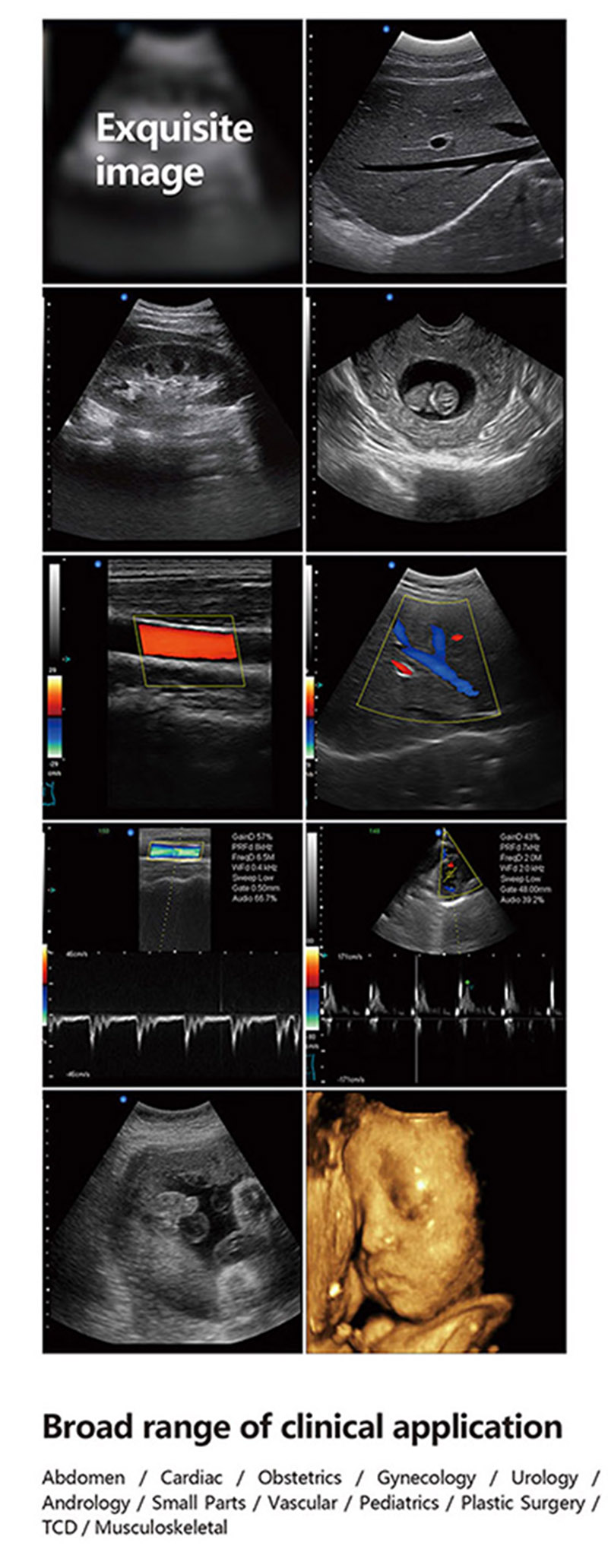 19 Inch 4D Trolley Color Doppler (PW) Ultrasound Machine 6
