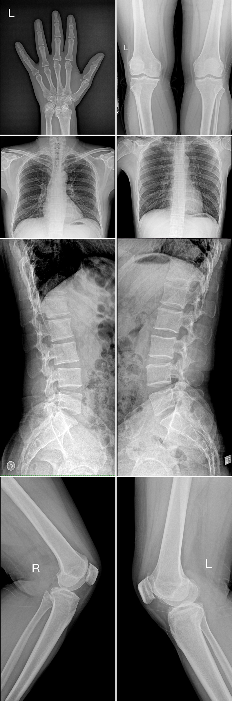 medical x-ray system medical x-ray system