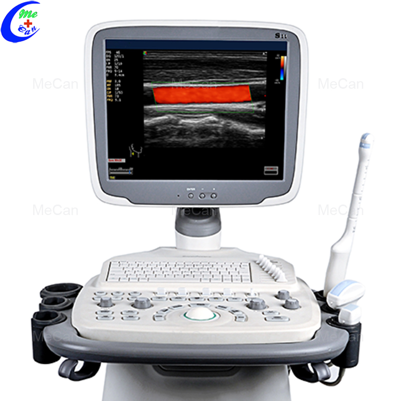 15 Inch LCD Trolley Color Doppler System Ultrasound Machine 6