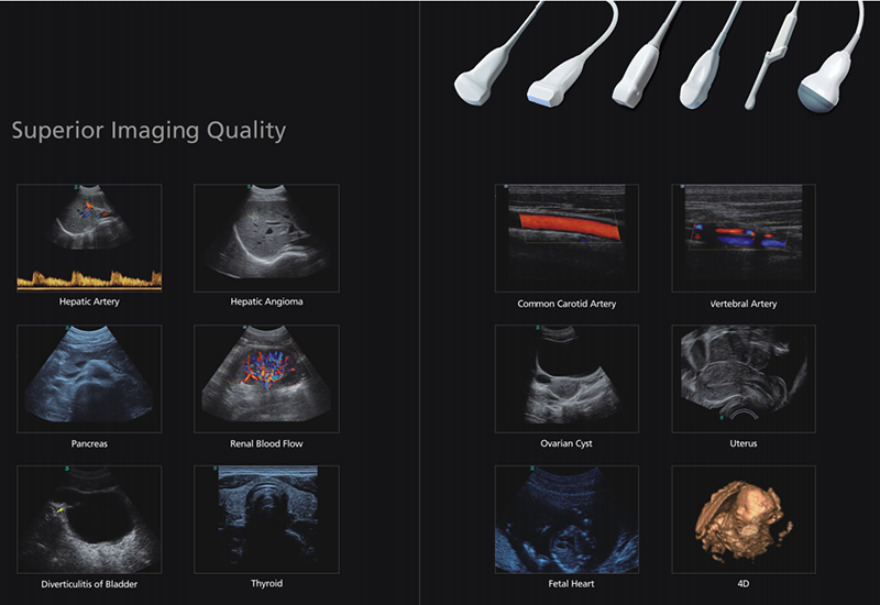 Trolley Color Doppler Trolley Color Doppler