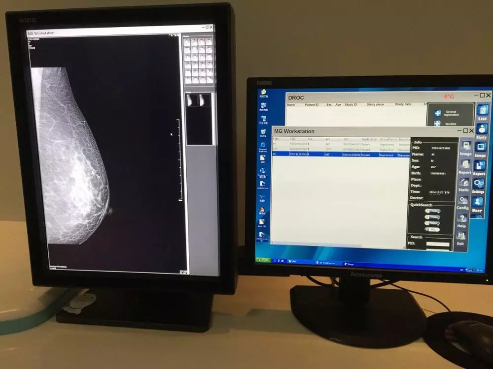 Mammography X Ray Machine Equipment, Mammography Unit 7