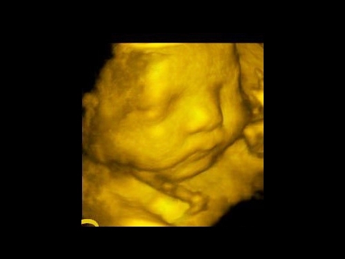 4D Ultrasound Machine 4D Ultrasound Machine
