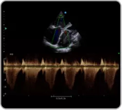 4D Ultrasound Machine 4D Ultrasound Machine