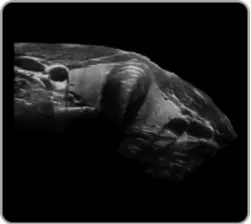 4D Ultrasound Machine 4D Ultrasound Machine