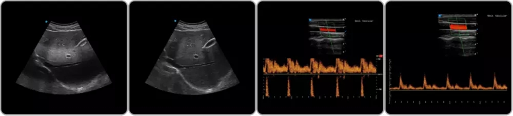 4D Ultrasound Machine 4D Ultrasound Machine