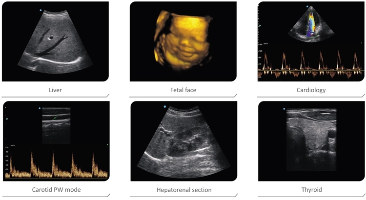 Portable Ultrasound Machine 3D 4D Portable Ultrasound Machine 3D 4D