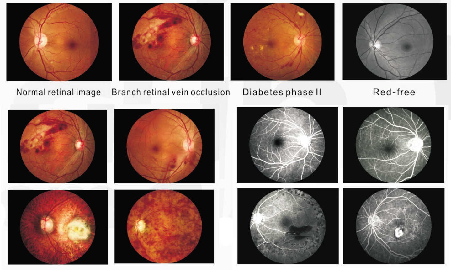 Non-mydriatic Eye Digital Fundus Camera Non-mydriatic Eye Digital Fundus Camera