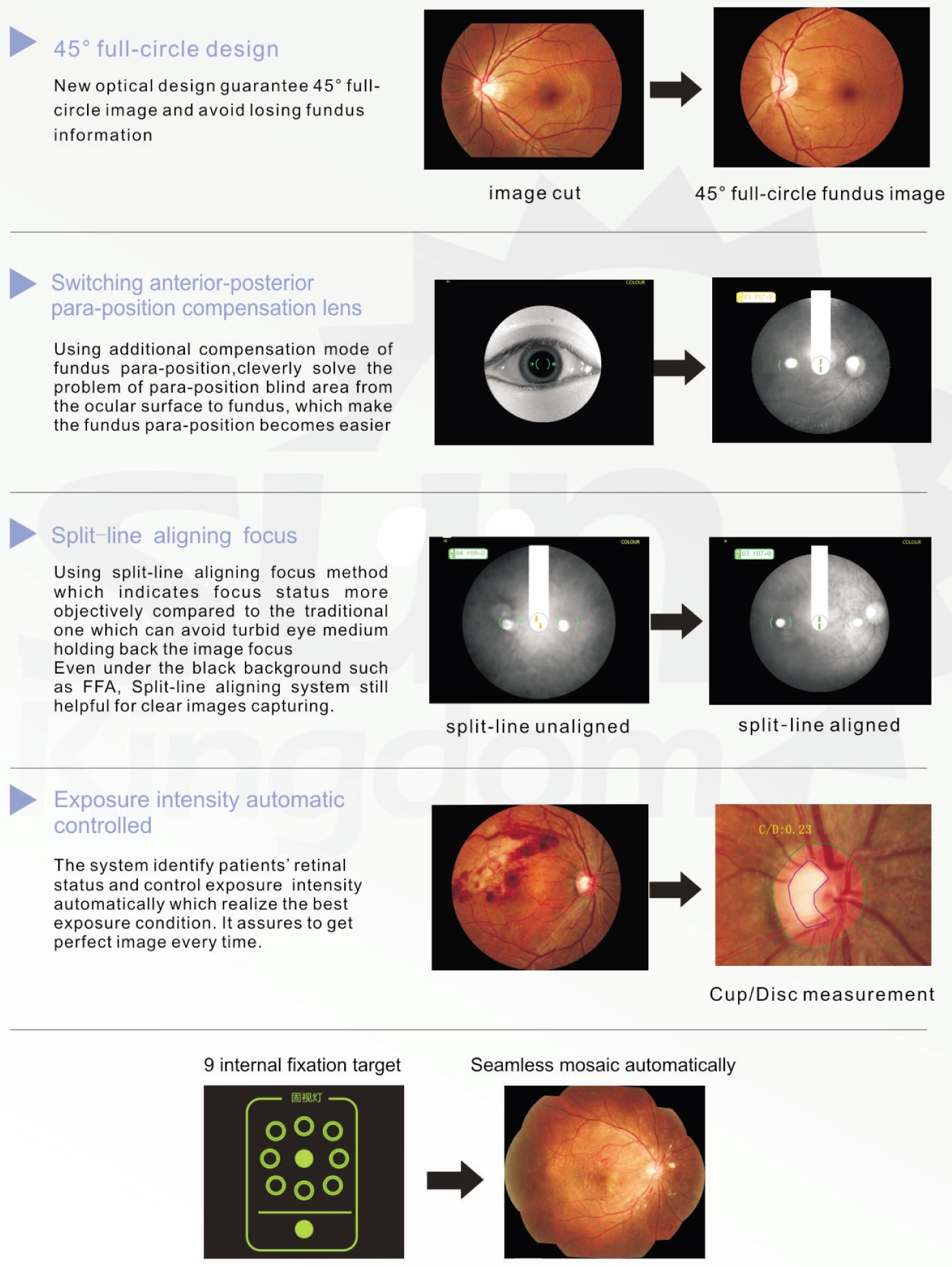 Non-mydriatic Eye Digital Fundus Camera Non-mydriatic Eye Digital Fundus Camera
