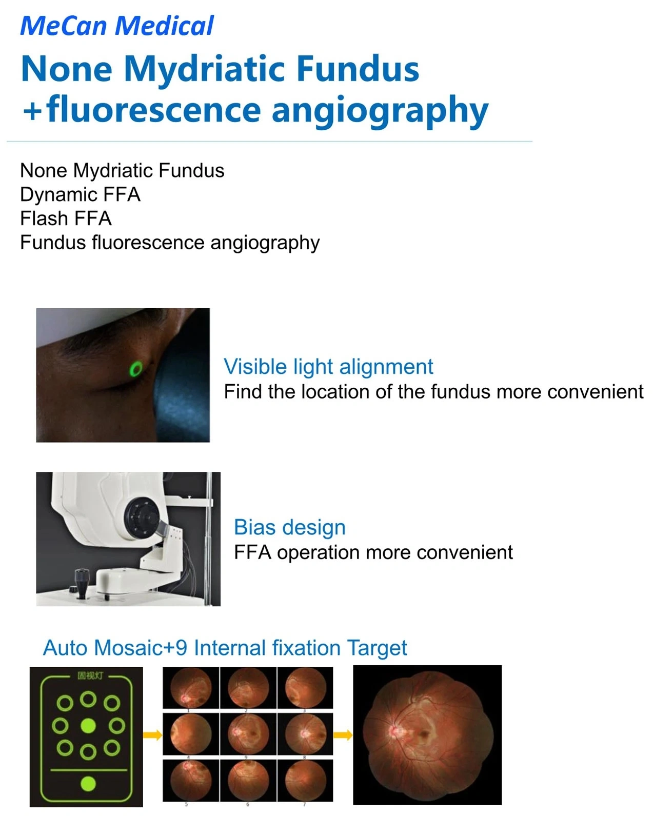 Non-mydriatic Eye Digital Fundus Camera Non-mydriatic Eye Digital Fundus Camera