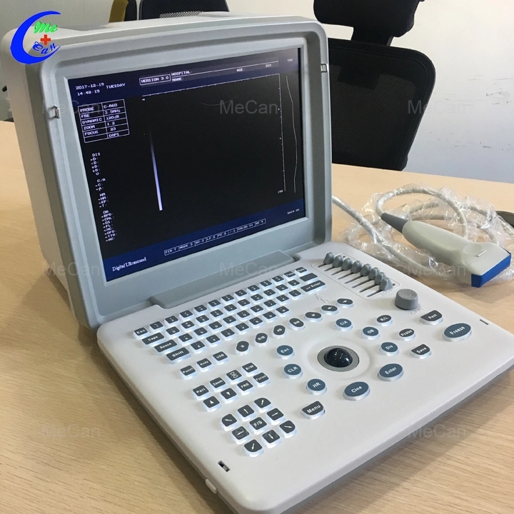Medical Diagnostic Portable B Ultrasound Machine For Pregnancy 10