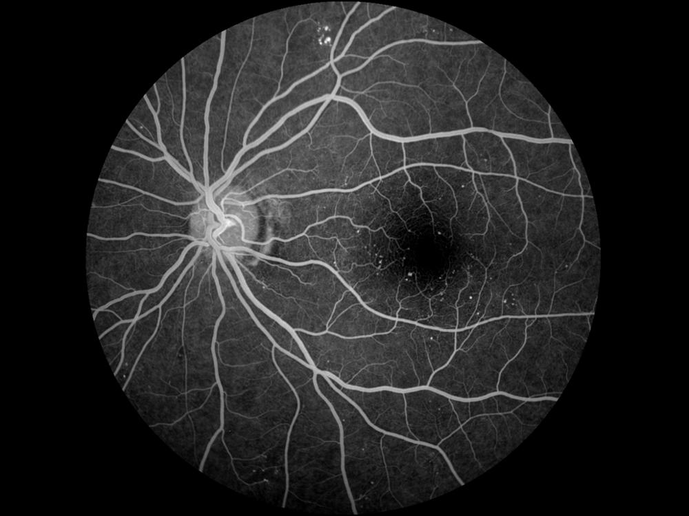 Non-mydriatic Eye Digital Fundus Camera Non-mydriatic Eye Digital Fundus Camera