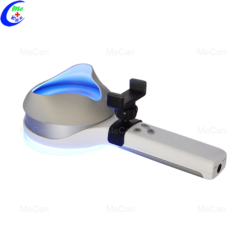 Portable Medical 365nm Woods Lamp for Skin Analysis 6