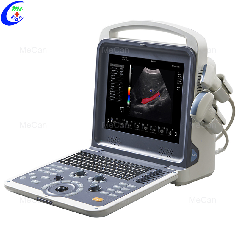 Portable Ecografo 4D Color Doppler Ultrasound Machine 4
