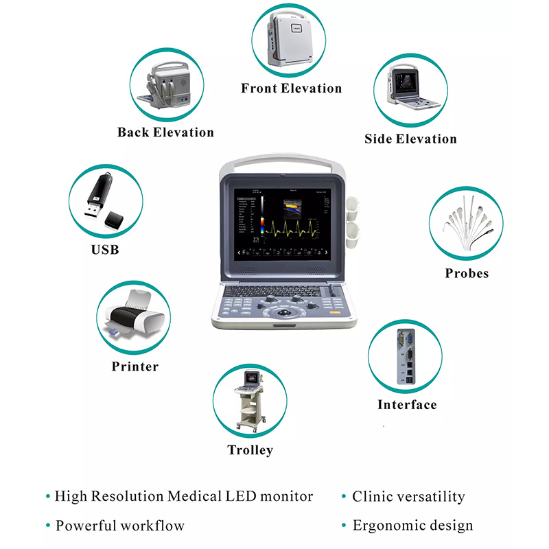 Portable Ecografo 4D Color Doppler Ultrasound Machine 5