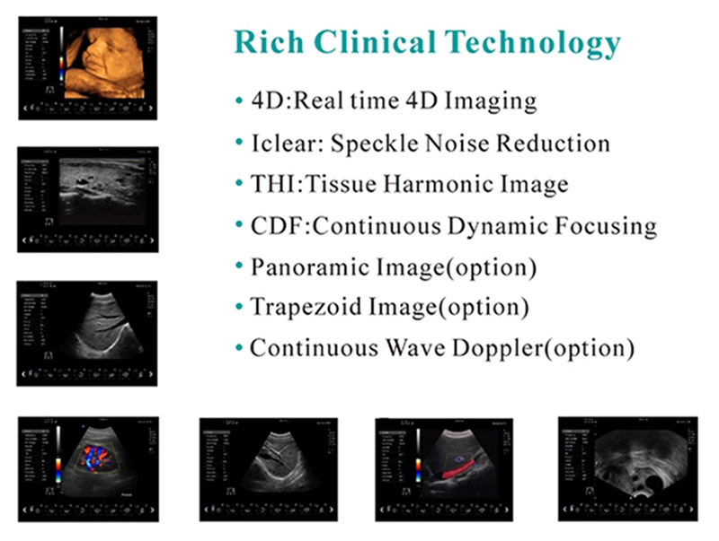 Portable Ecografo 4D Color Doppler Ultrasound Machine 6