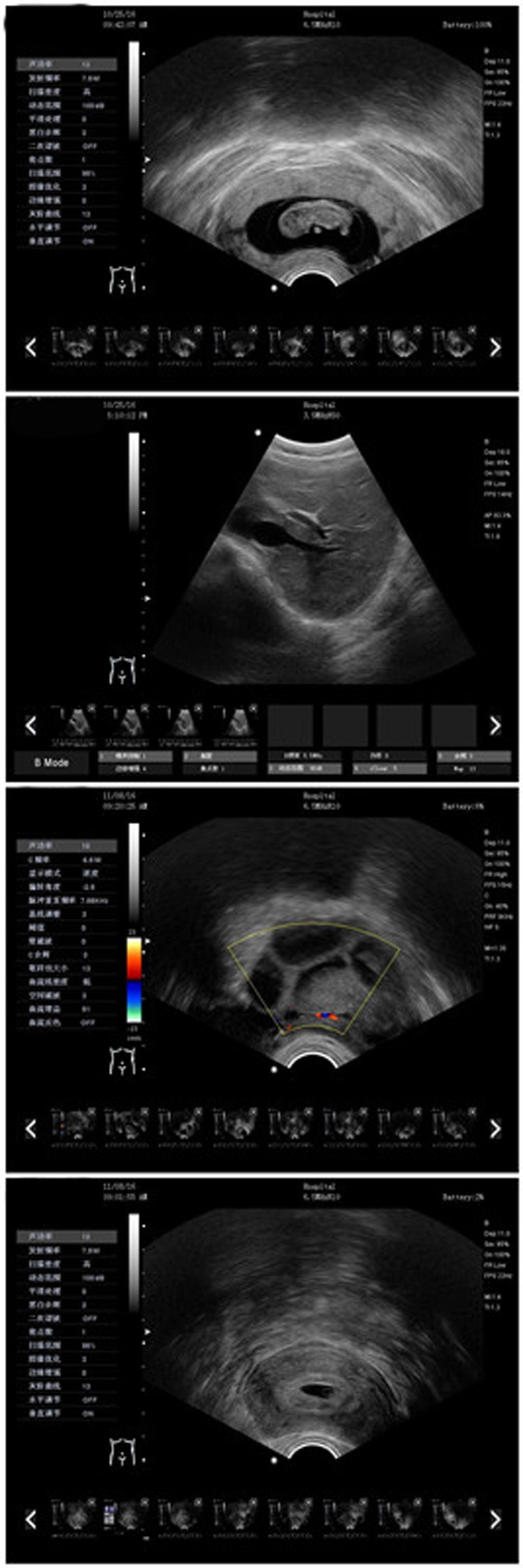 Portable Ecografo 4D Color Doppler Ultrasound Machine 7
