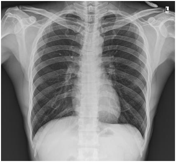 Digital Portable X-ray System