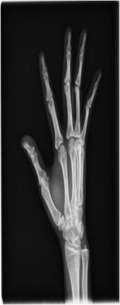 Digital Portable X-ray System
