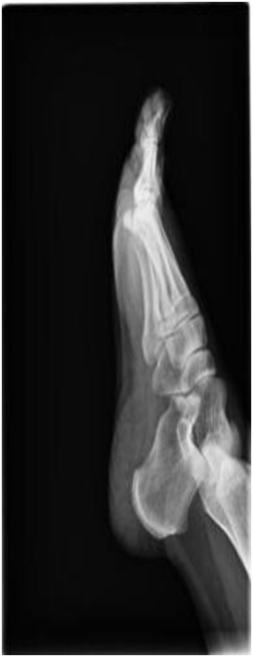 Digital Portable X-ray System