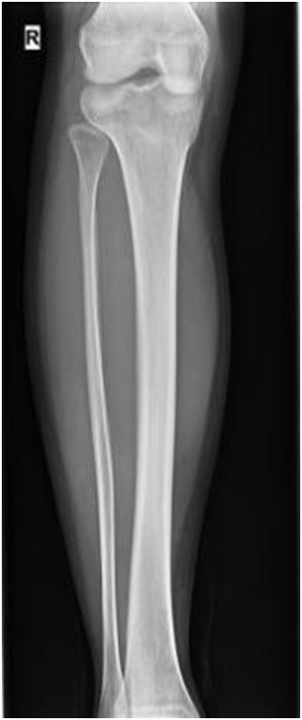Digital Portable X-ray System
