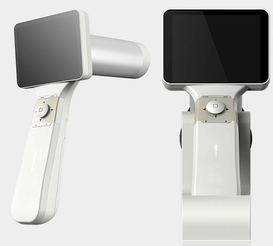 digital fundus camera digital fundus camera