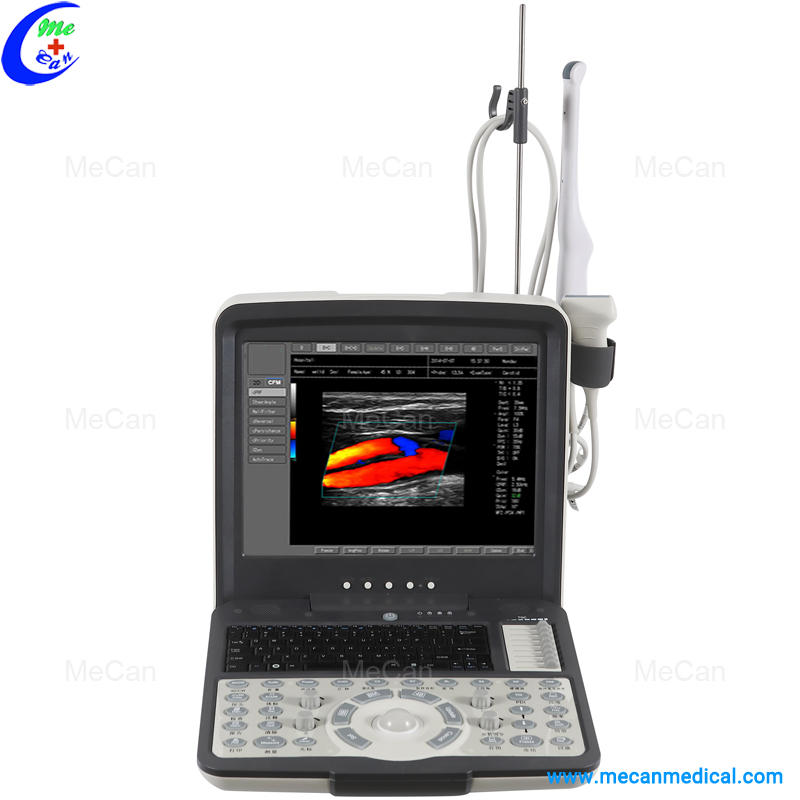 Portable Color Doppler