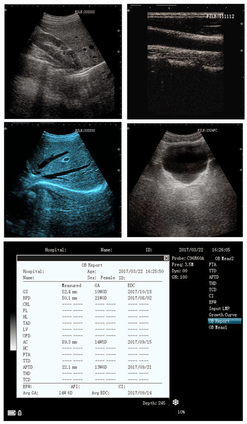 laptop ultrasound scanner laptop ultrasound scanner