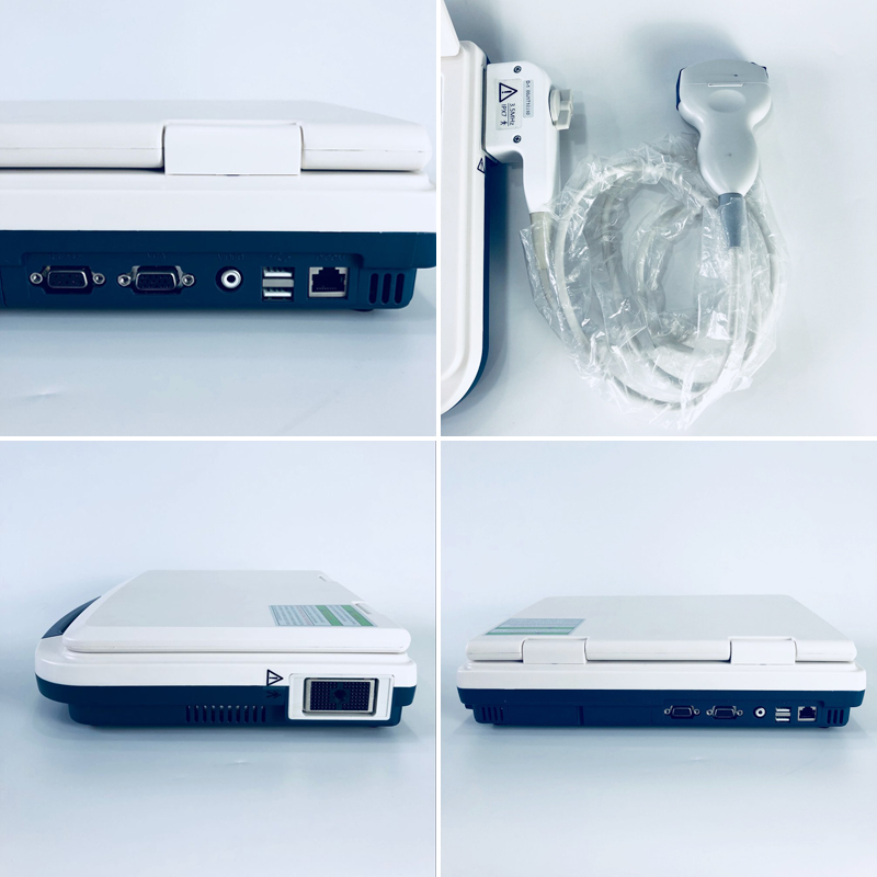 echo ultrasound scanner echo ultrasound scanner
